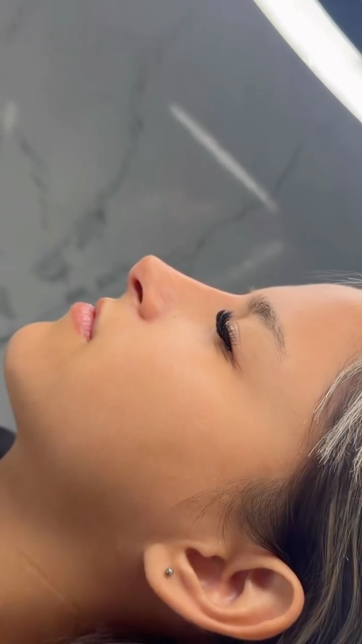 Dr Lautaro Franco Aesthetic Medicine Facebook ad: 5 min, poca dosis y en el punto…