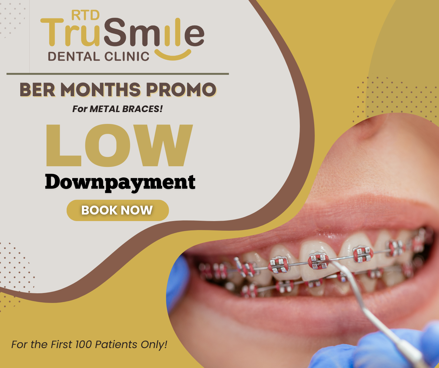 RTD TruSmile Dental Clinic Facebook ad from Oct 12, 2024