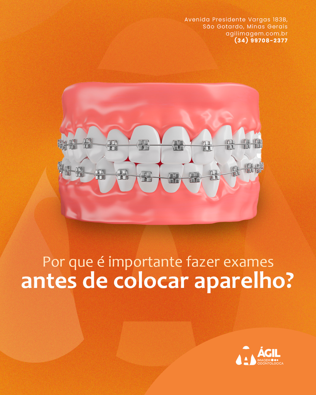 Ágil Imagem Facebook ad: Antes de iniciar qualquer tratamento ortodôntico, é…