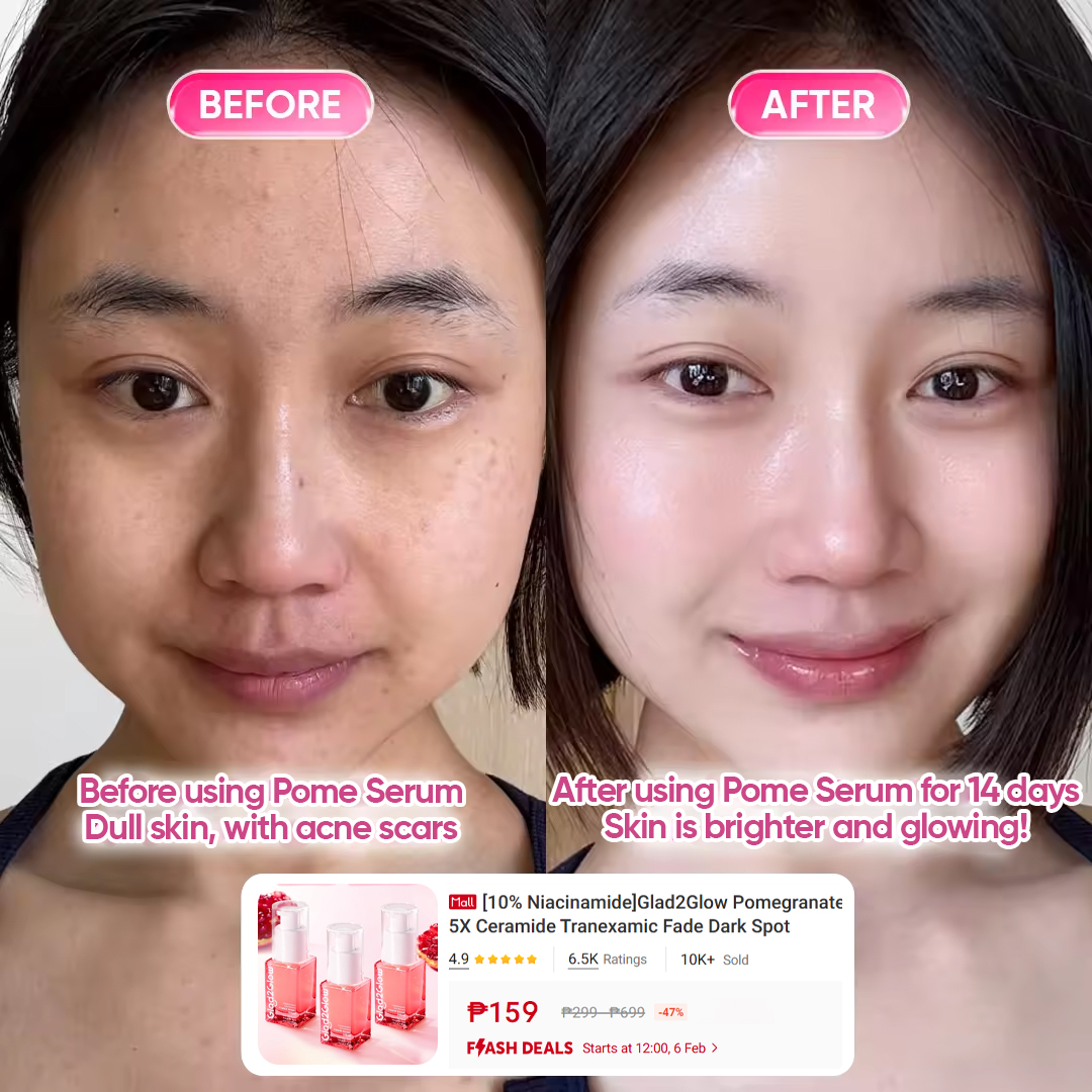 Glad2GlowPhilippines Facebook ad