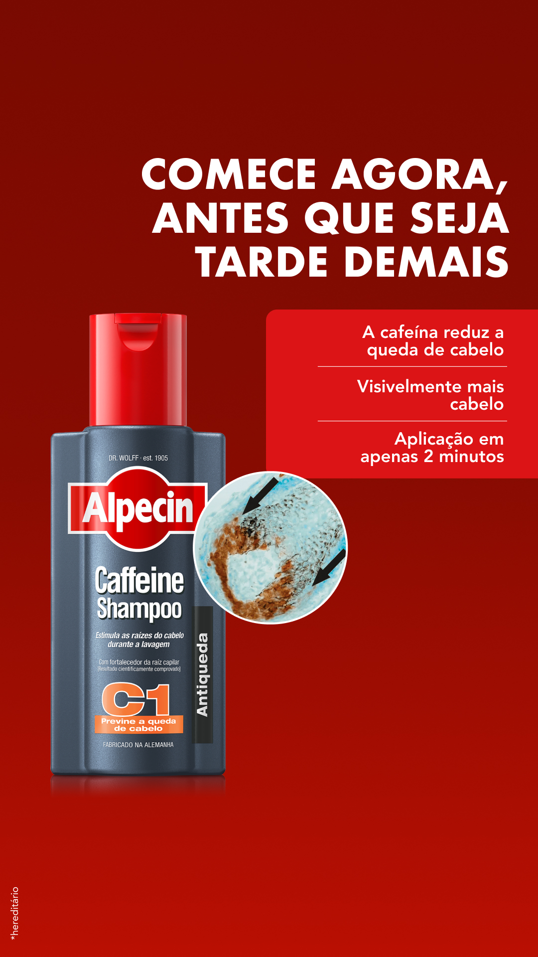 Alpecin Brasil Facebook ad