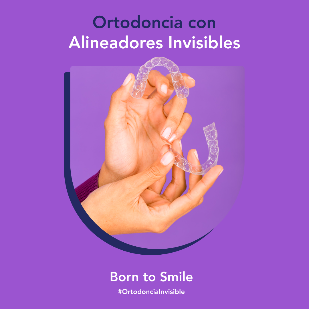 Üforia Facebook ad: ¿En qué casos puedo usar los alineadores?