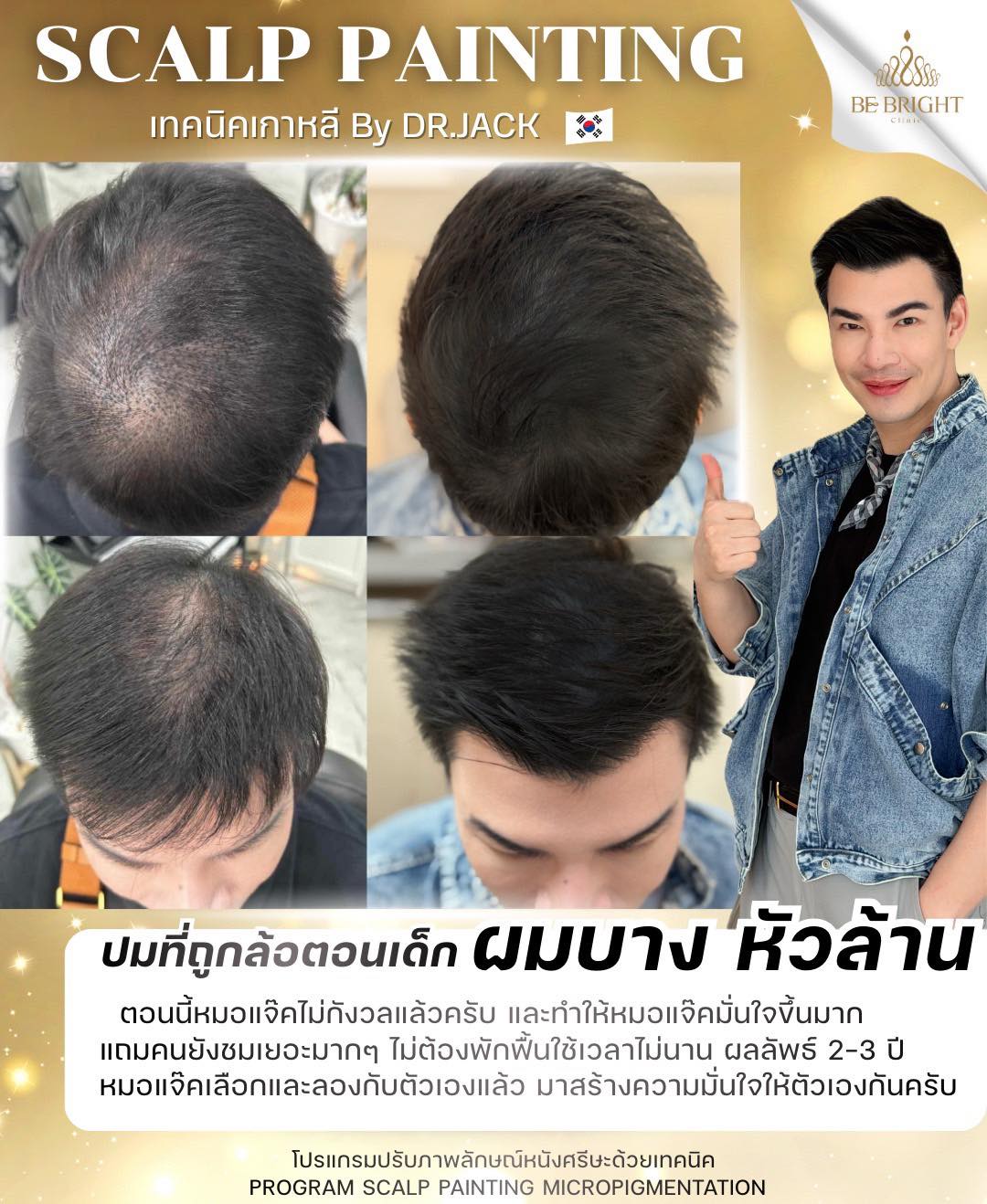 Be Bright clinic by Dr.Jack Facebook ad: คำว่าหัวล้าน ผมบาง ไข่ดาว