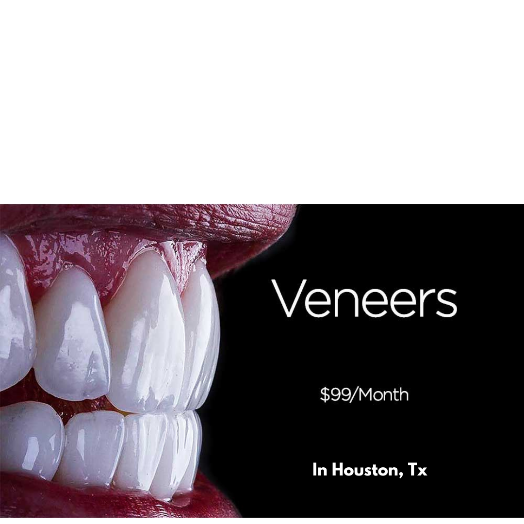 Nu Dentistry Facebook ad: Veneers Starting at $99/month