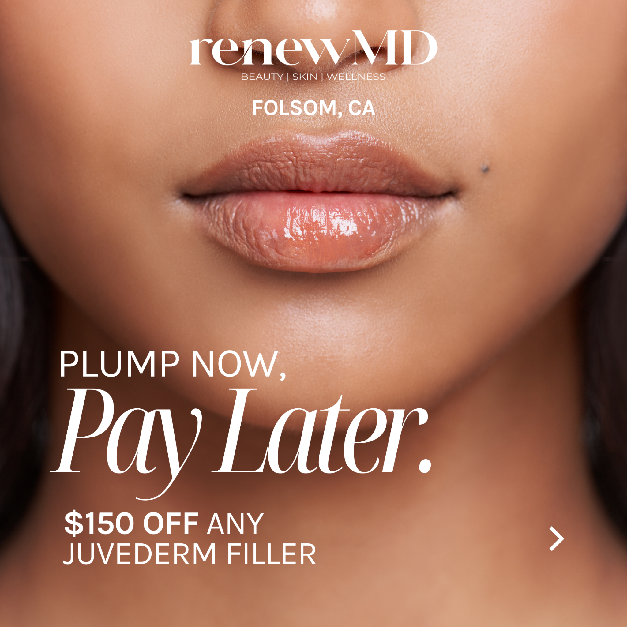Renew MD Wellness Facebook ad