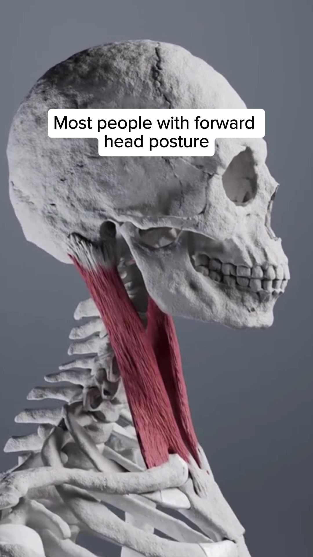CALLIXE Facebook ad: No More Neck Pain | 1000+ Happy Sleepers