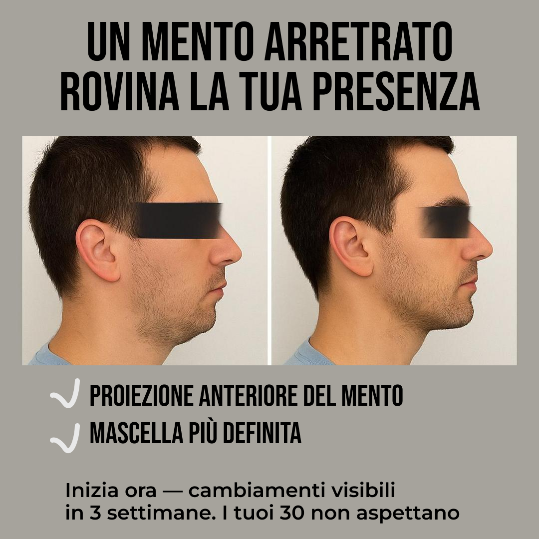 Mark Mewing Facebook ad