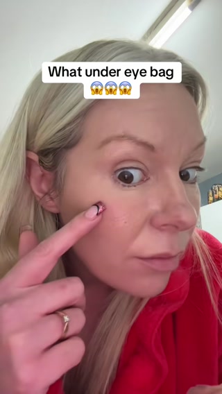 Dr.Melaxin UK Facebook ad: How to care for eye bags without surgery to remove fat…
