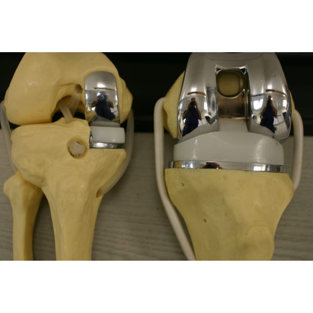The Wellbeing Note Facebook ad: Bone-On-Bone Knee Pain? Read This
