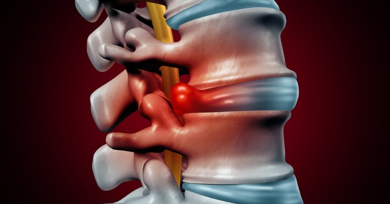 Carolina Chiropractic Facebook ad