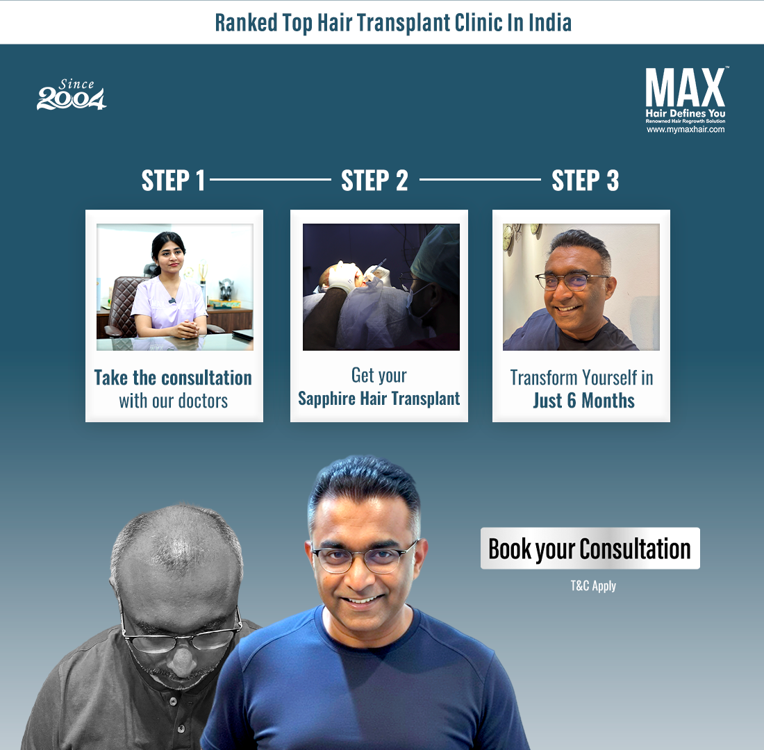 MAX Hair Clinic Facebook ad