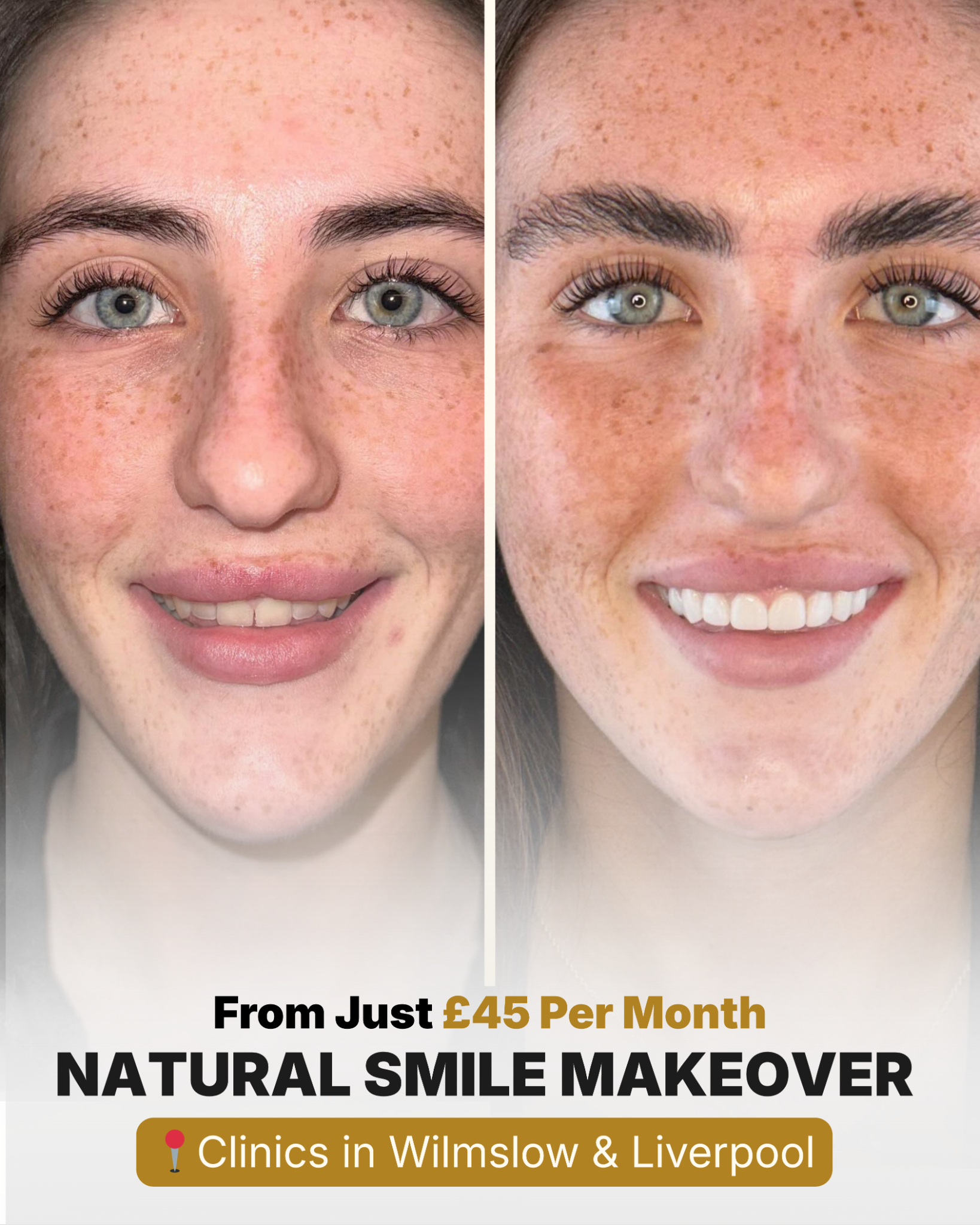 Transform Dental Facebook ad