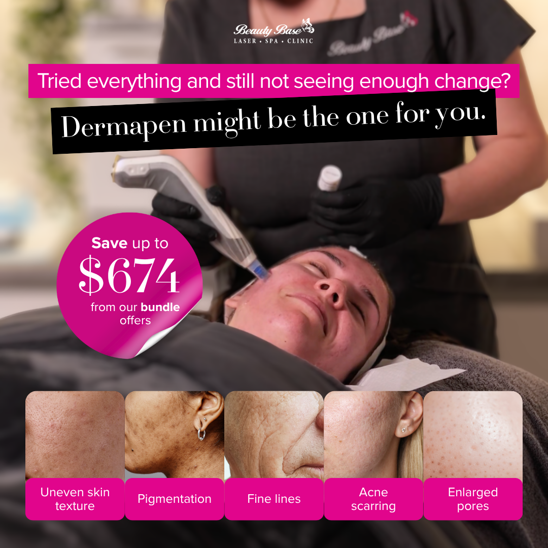 The Beauty Base Facebook ad: Our Dermapen Bundles are designed for guests who…