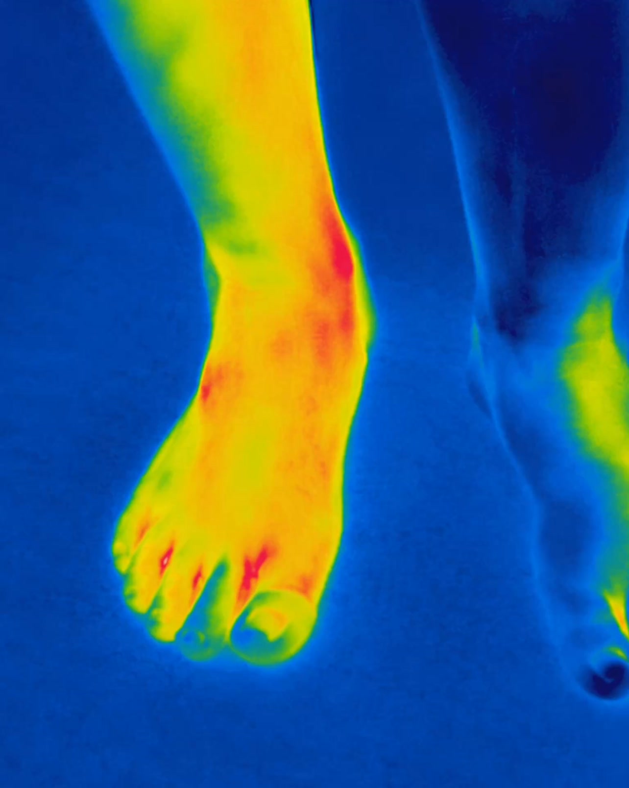 Regenerative Health Clinic Facebook ad: $47 Neuropathy Exam + 1st Treatment