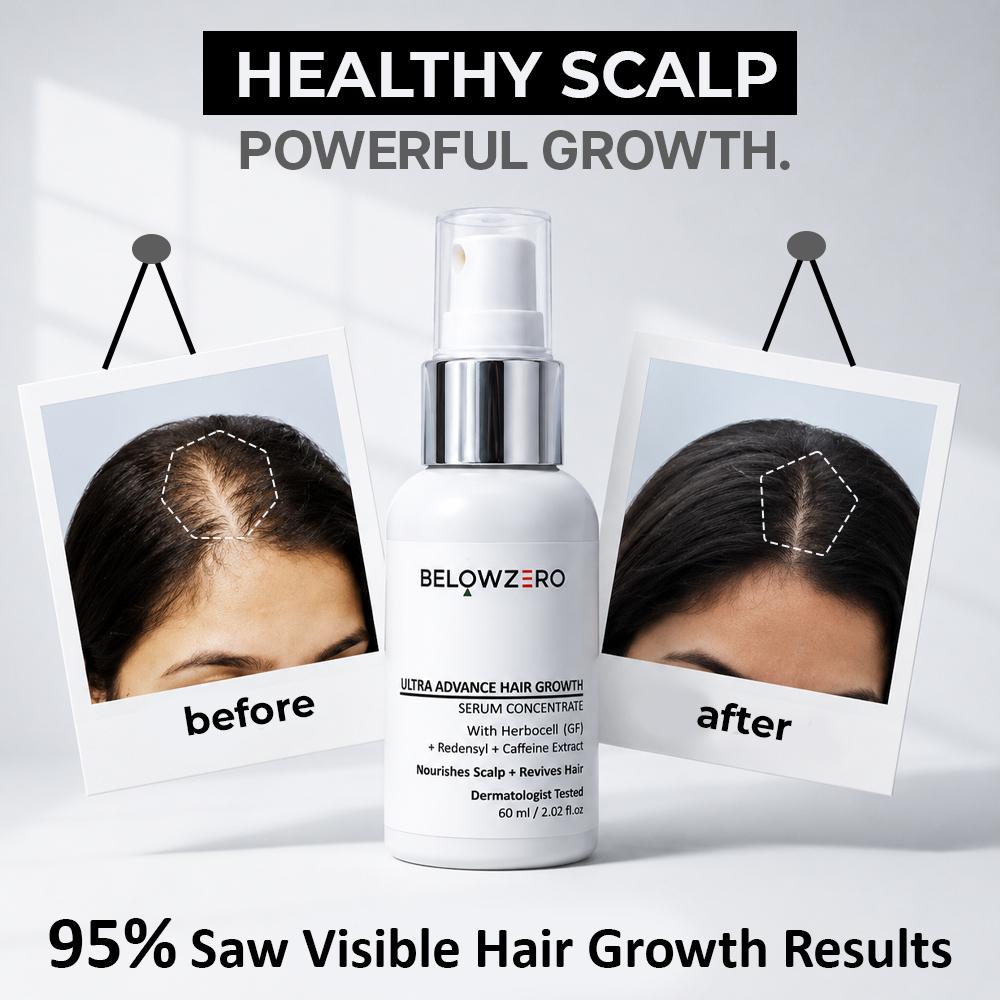 Belowzero Facebook ad