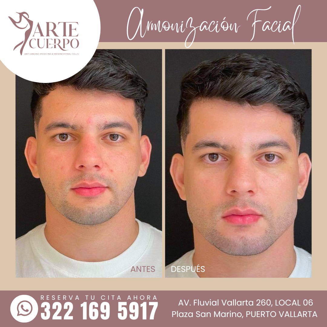 Clinica spa arte cuerpo  Facebook ad