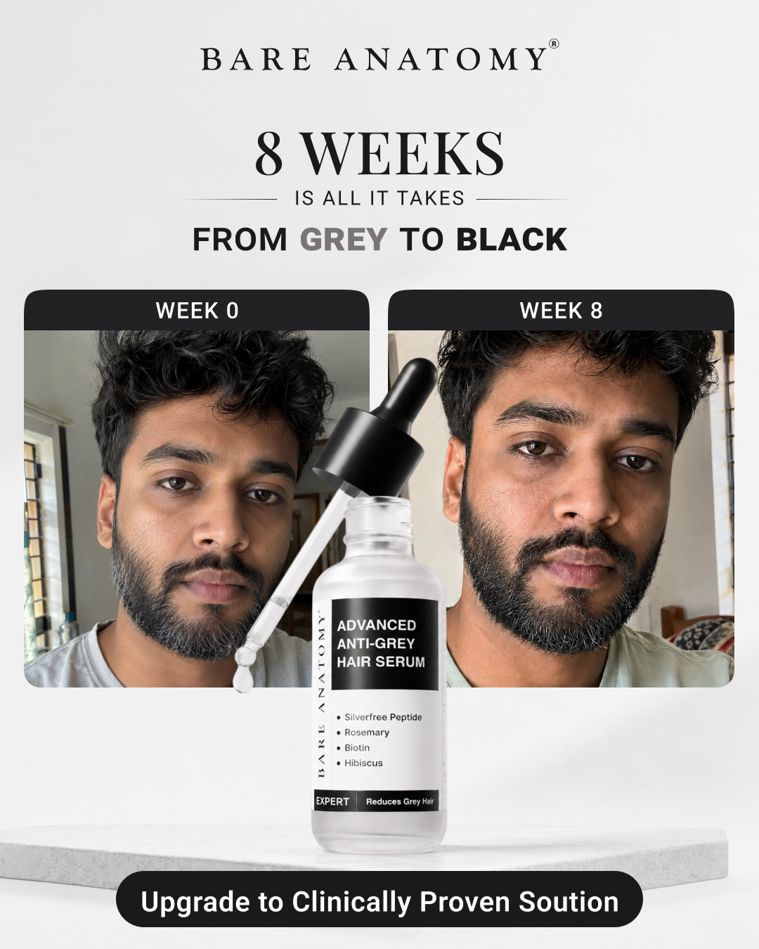 Bare Anatomy Facebook ad