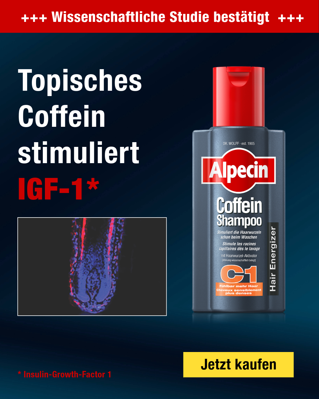 Alpecin Facebook ad from Jun 4, 2026