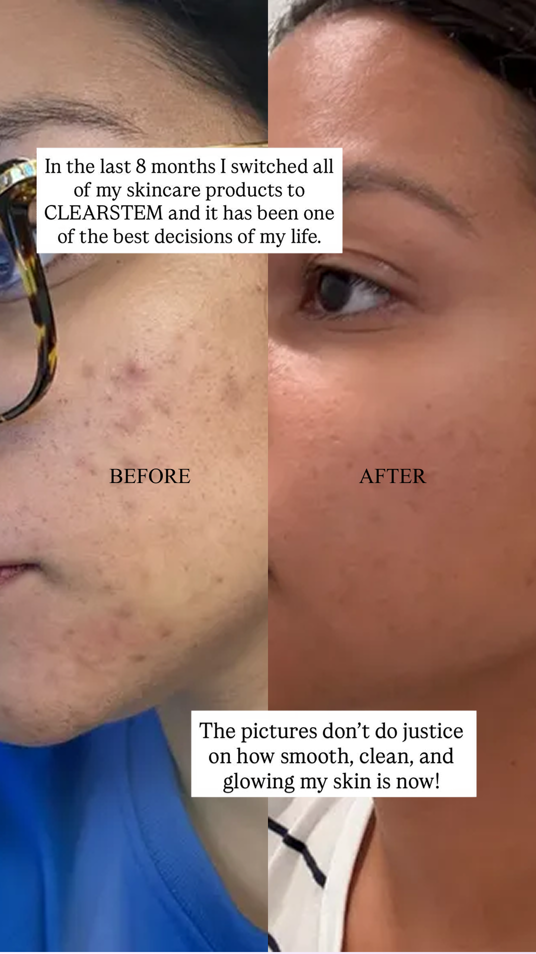 CLEARSTEM Skincare Facebook ad