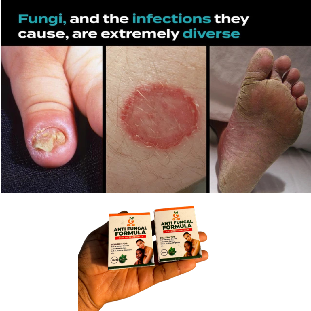 Fungal Natural Remedy Facebook ad