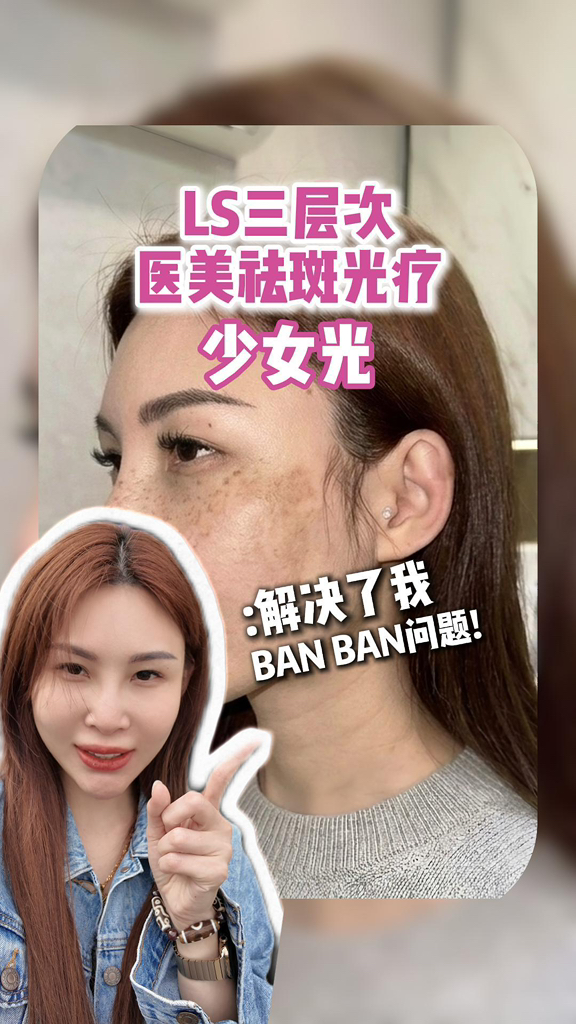 LeSkin Clinic医美诊所-LCP认证 Facebook ad: 防晒做足了,护肤品没少用,斑还是在?