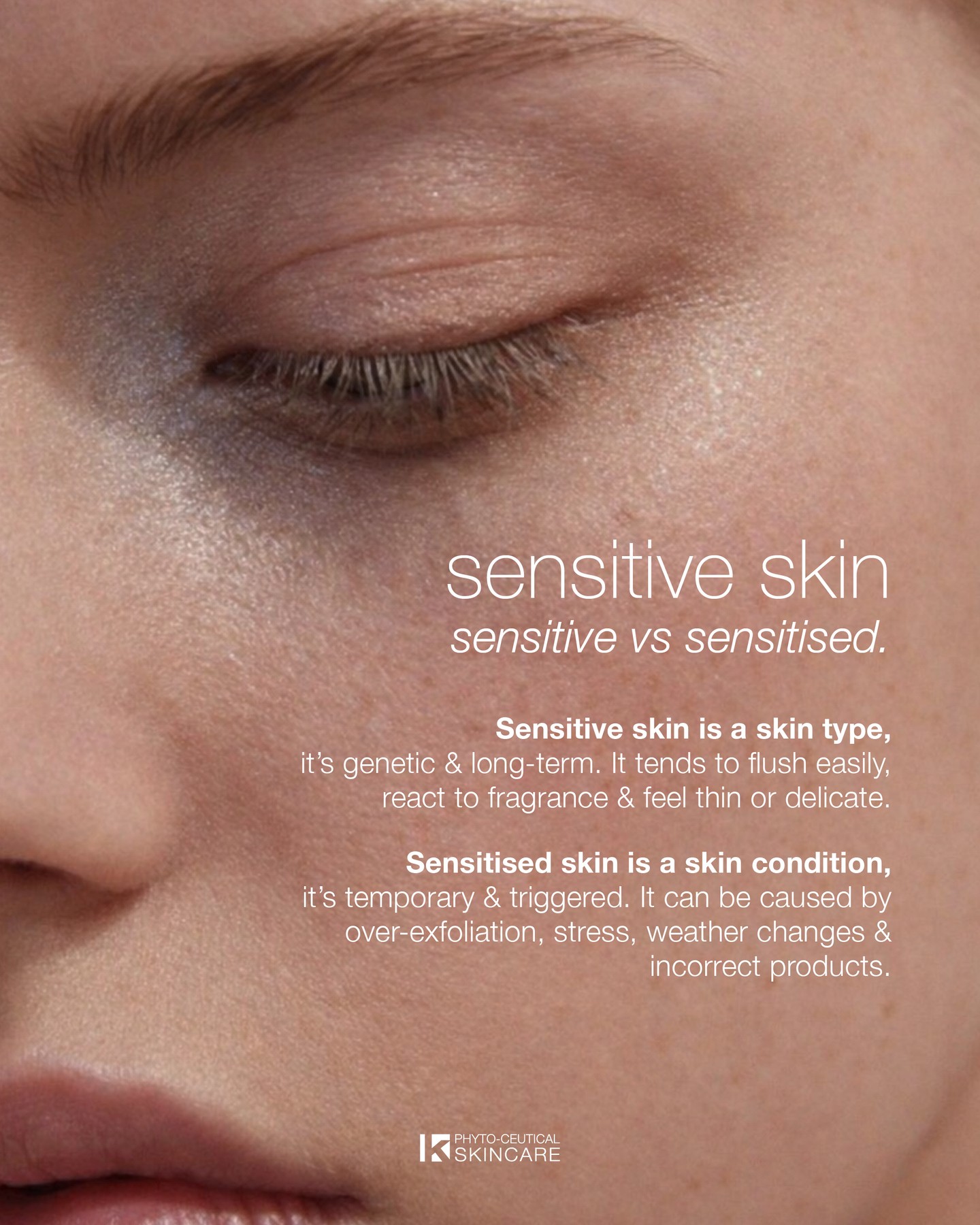 Franck Global Facebook ad: Sensitive skin isn’t a flaw, it’s a skin…