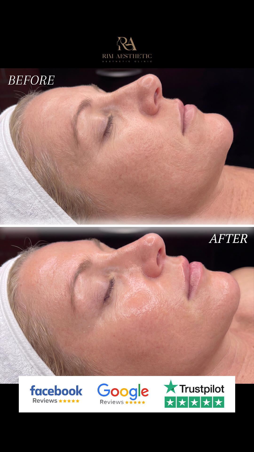 Rim Aesthetic Facebook ad: Barking girlies, are you Tired of Dull, Congested Skin…