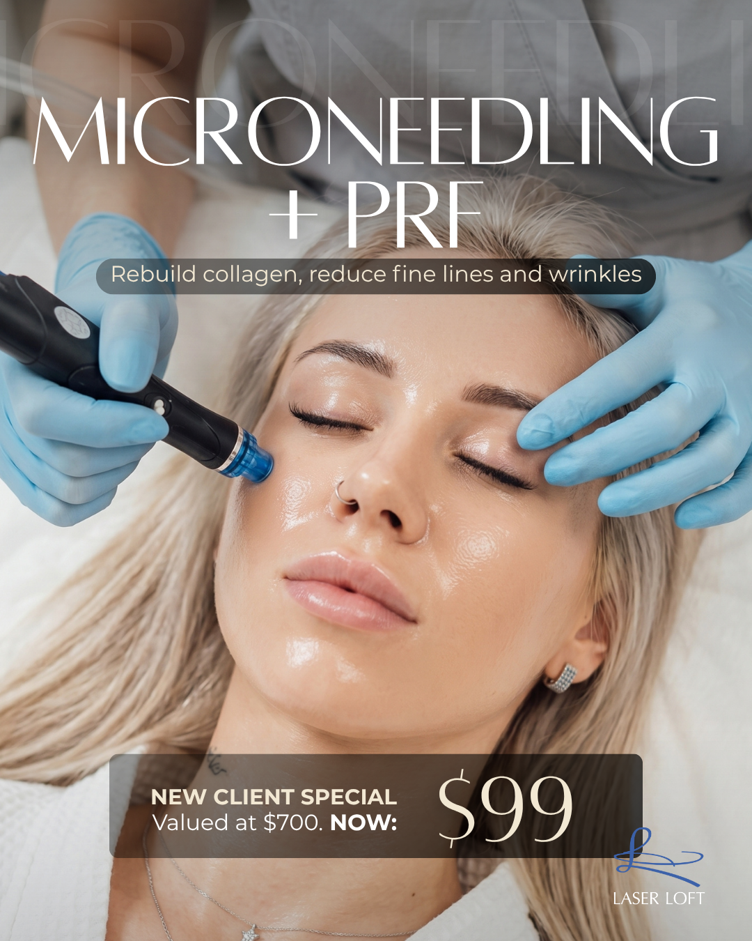 Laser Loft Facebook ad