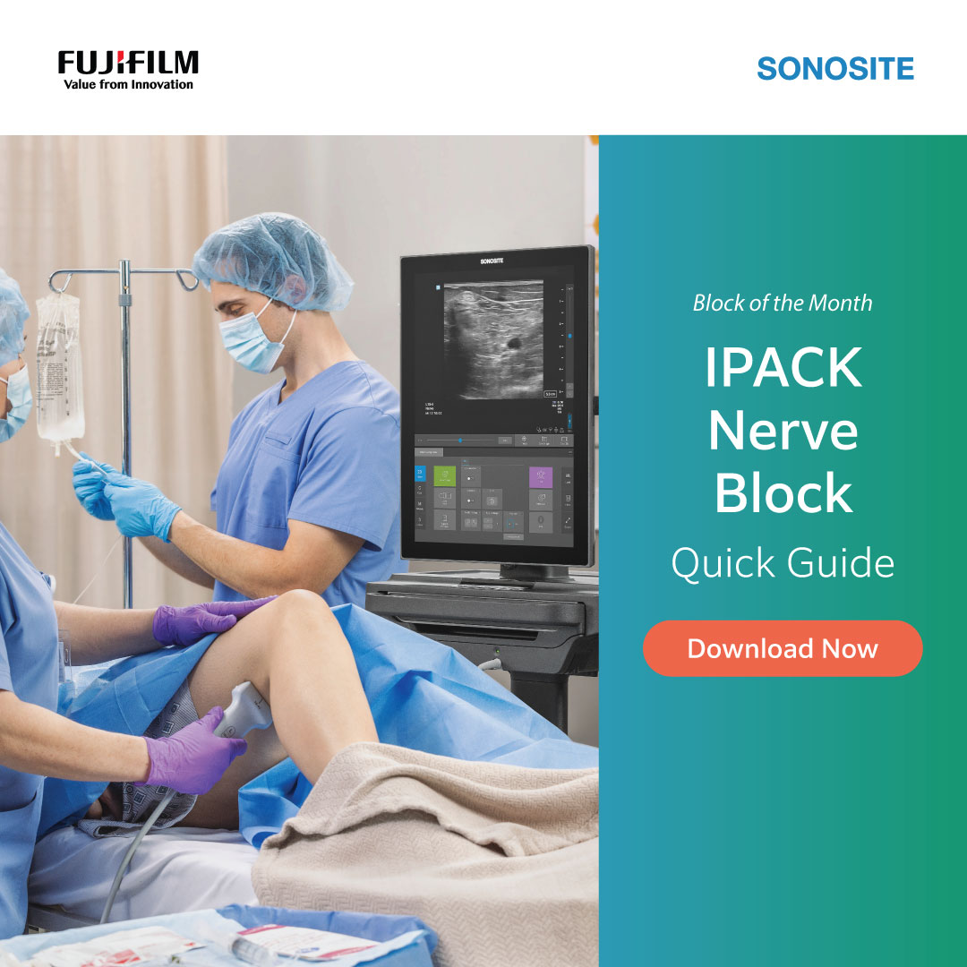 Fujifilm Sonosite Facebook ad