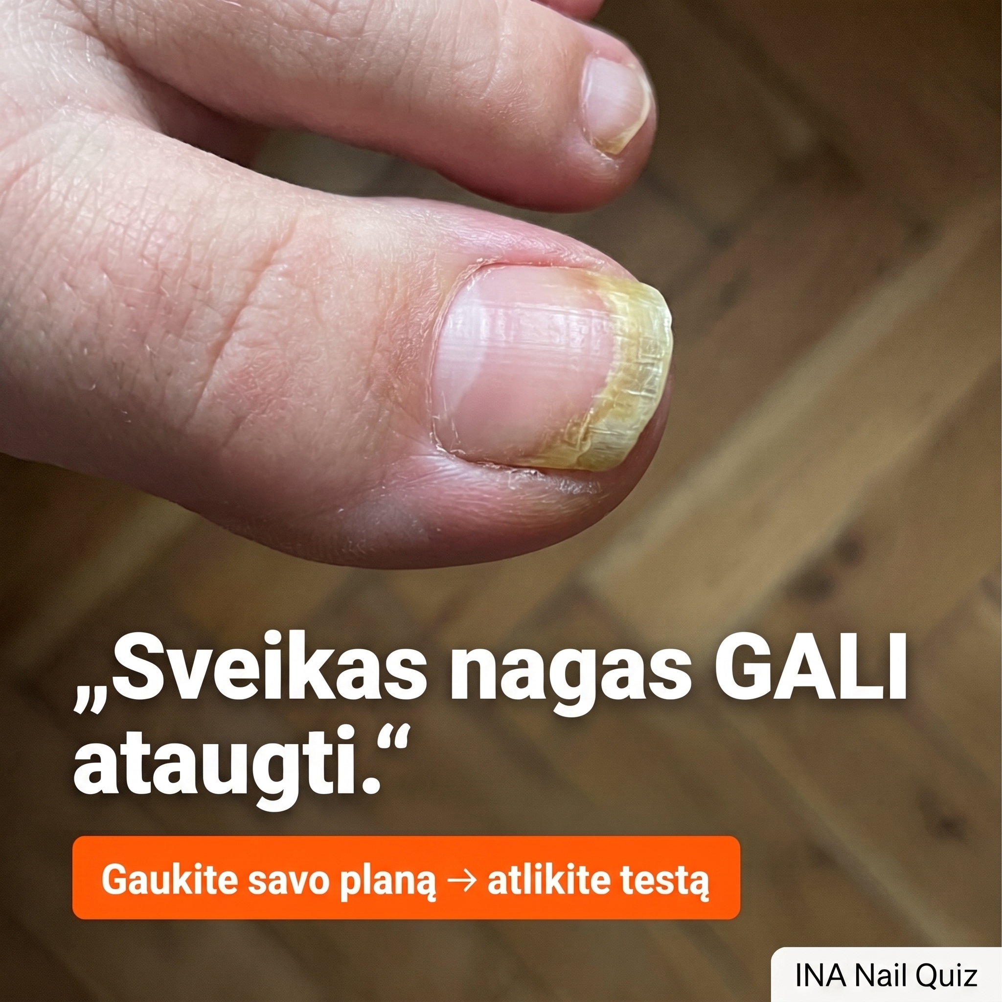 Organinė Kosmetika - InaEssentials.LT Facebook ad: Sveikas nagas GALI ataugti.