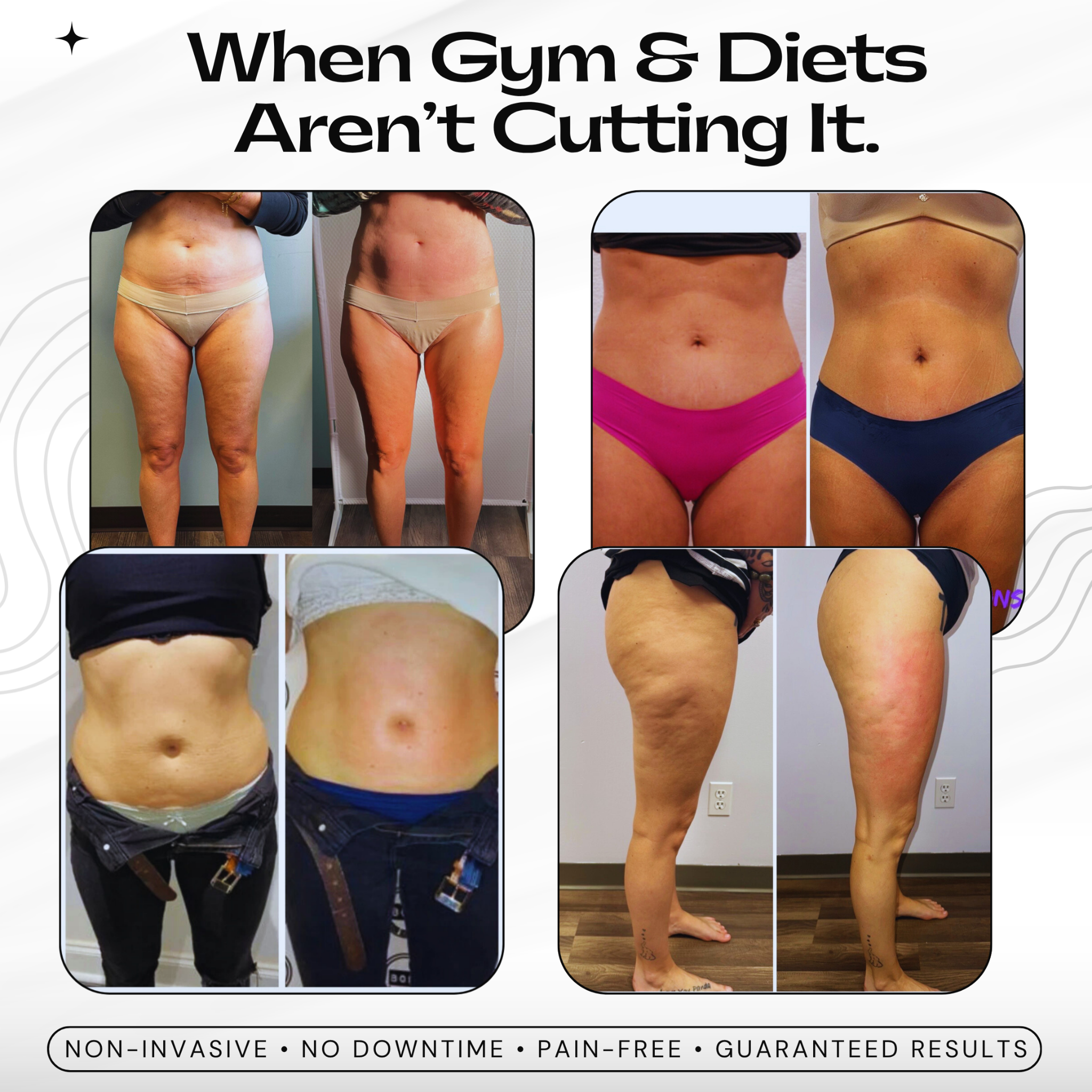 Elite Aesthetics & Medical Care, LLC Facebook ad: T-Shape Skin Tightening Special - $159 ONLY