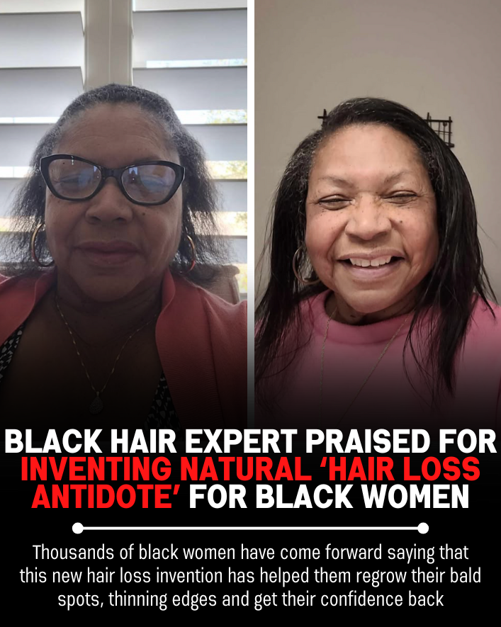 Black Hair Growth Remedy Facebook ad