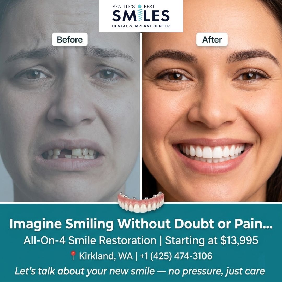 Seattle's Best Smiles Facebook ad: Renew Your Smile for $13,995