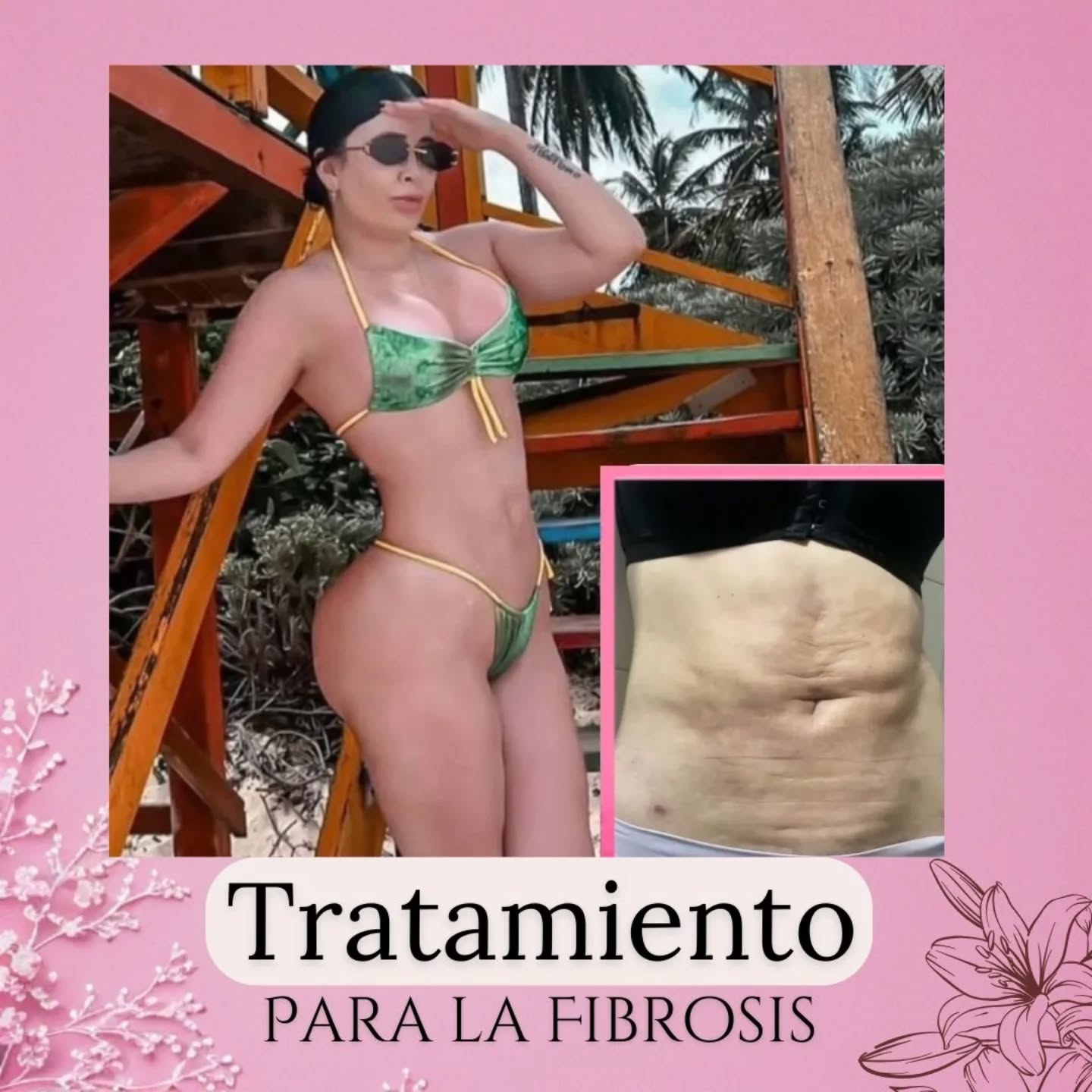 Soul And Body By Wendy De La Hoz Facebook ad: ¡Recupera tu piel de la fibrosis y luce…