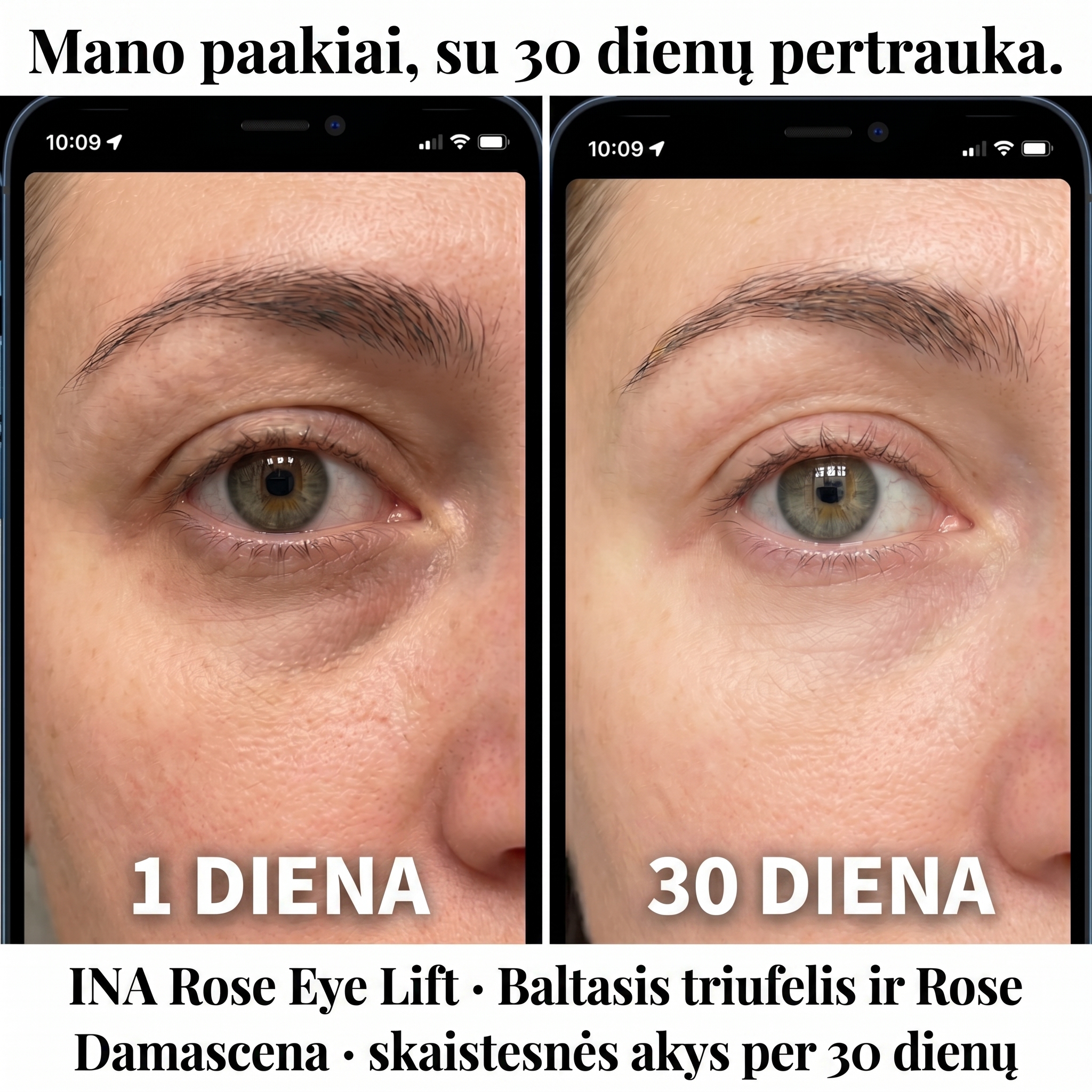 InaEssentials.lt - Šeimos Organinė Kosmetika Facebook ad: Mano paakių ratilai po 30 dienų.