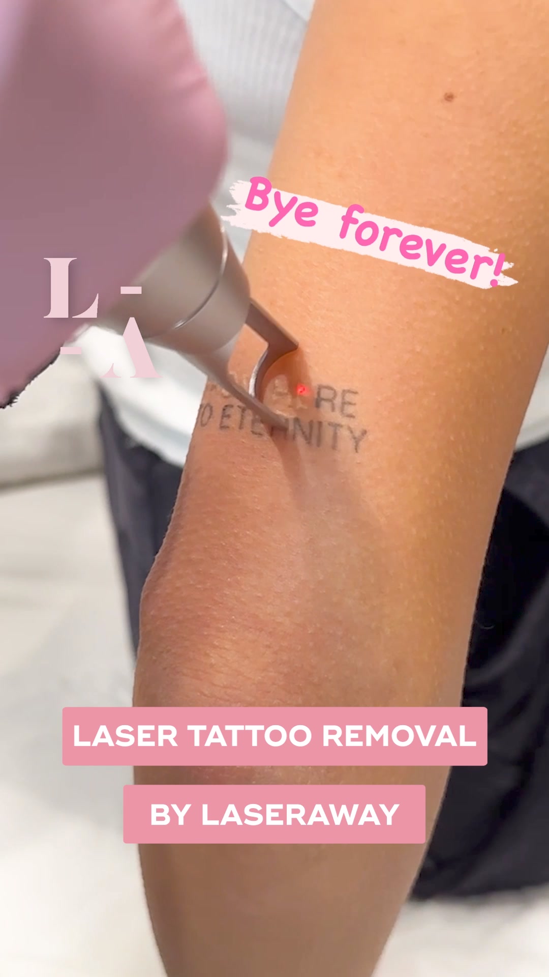 LaserAway Facebook ad: Erase Unwanted Ink