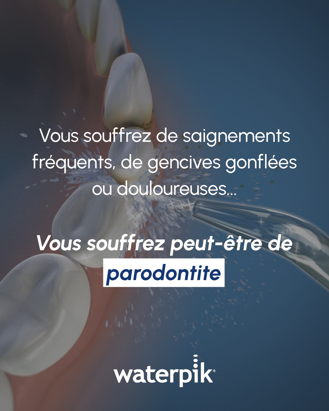 Frame 55 Facebook ad: Vos gencives sont sensibles?