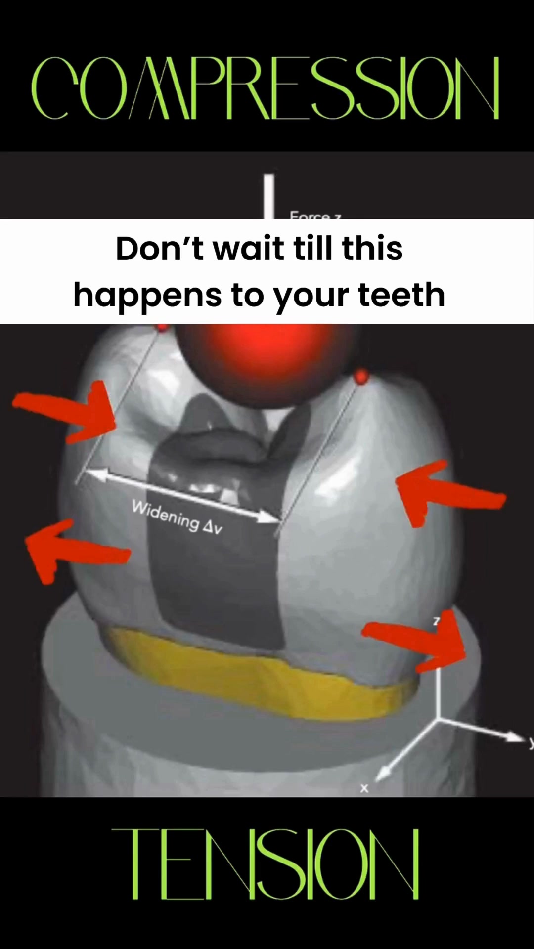 The Dental Diaries Facebook ad: Fluoride Free Cavity Protection