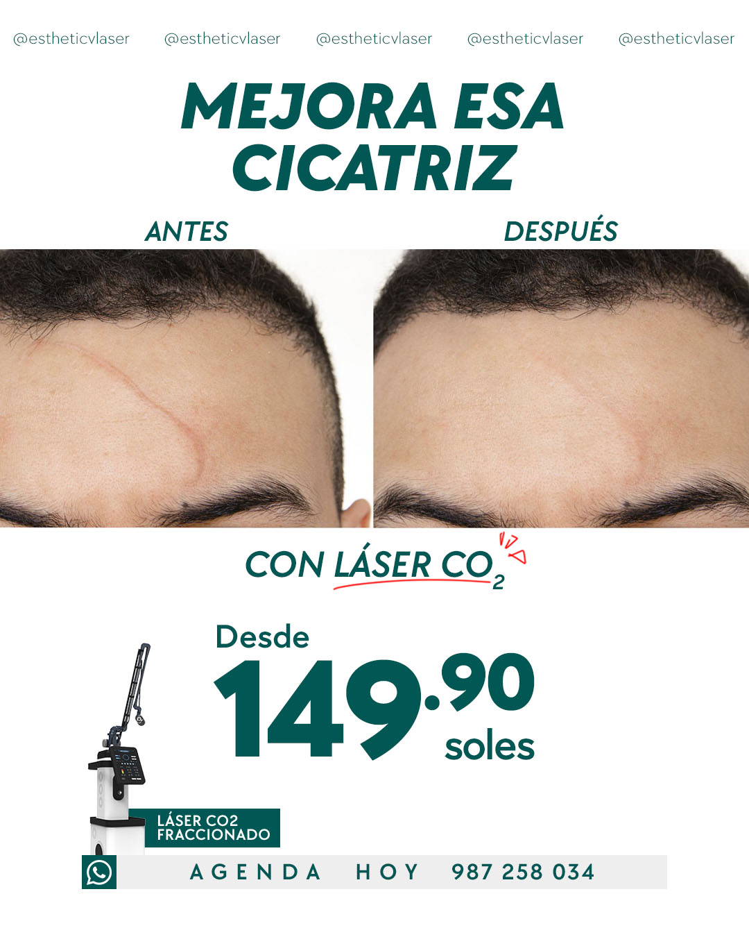 Esthétic v laser Chiclayo Facebook ad from Jun 8, 2026
