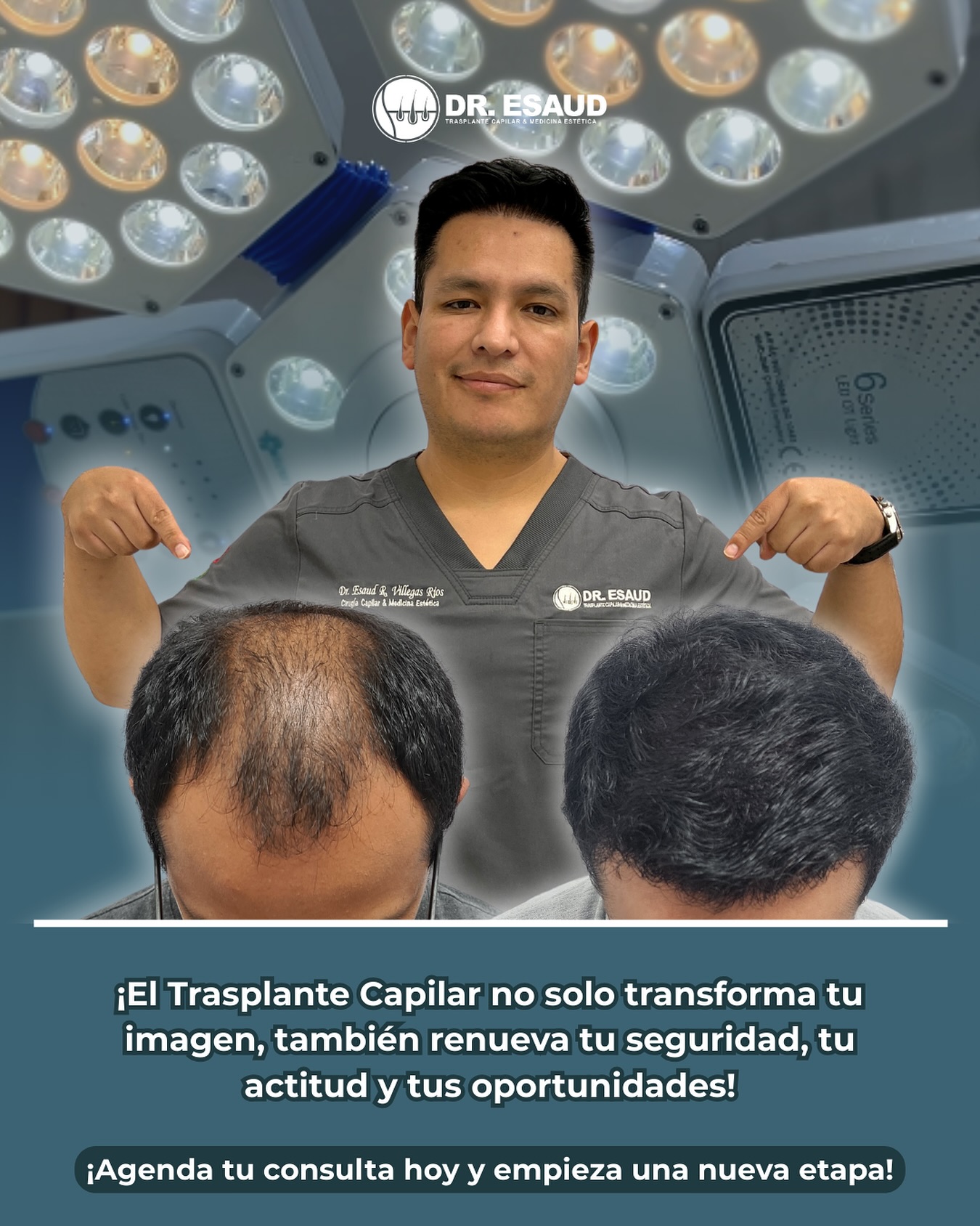 Dr. Esaud - Trasplante Capilar & Medicina Estética Facebook ad