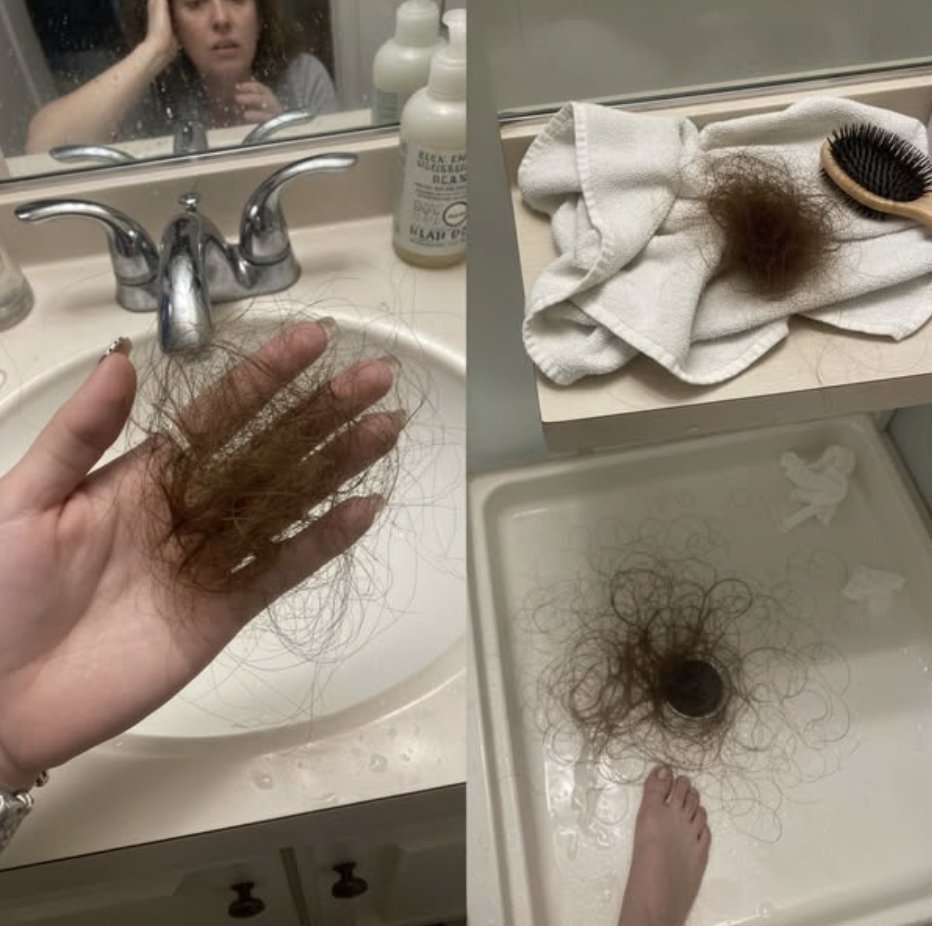 Amandine G.  Pertes de cheveux constantes Facebook ad