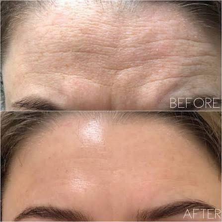 Charlie Louise Semi Permanent Makeup and Beauty Facebook ad