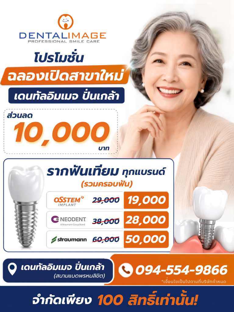 รากฟันเทียมราคาเพื่อคนไทย By Dentalimage Facebook ad: ฉลองเปิดสาขาปิ่นเกล้า รับส่วนลด 10,000 บาท