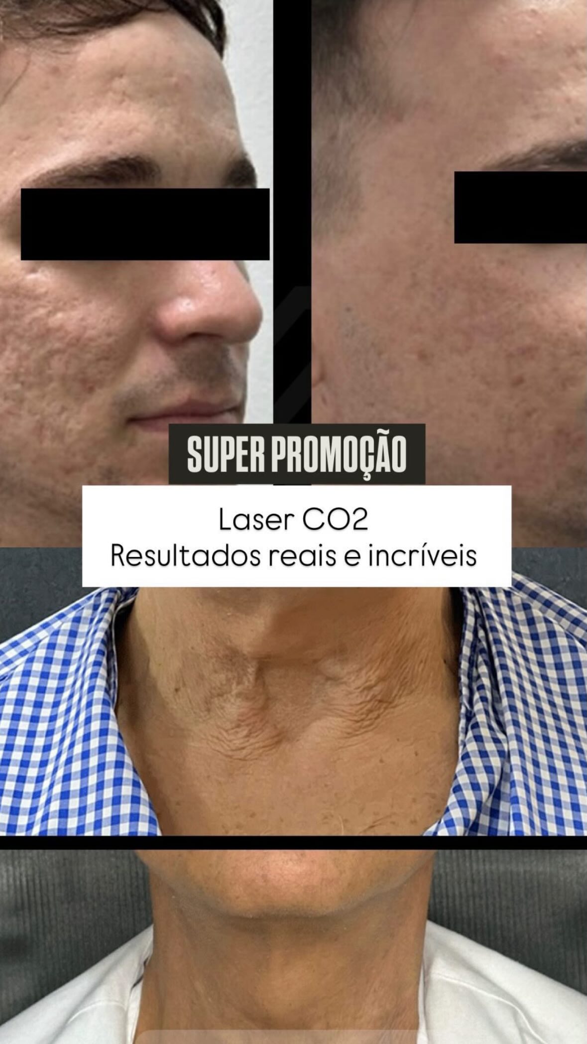 Academia da Face Alphaville Facebook ad from Feb 14, 2026