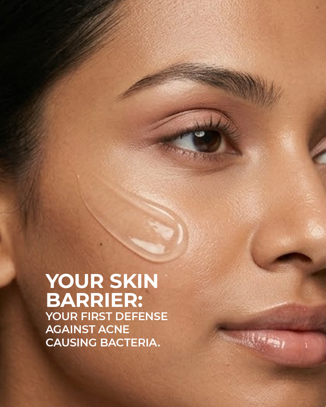 AcneStar Facebook ad: Your skin barrier is the first line of…