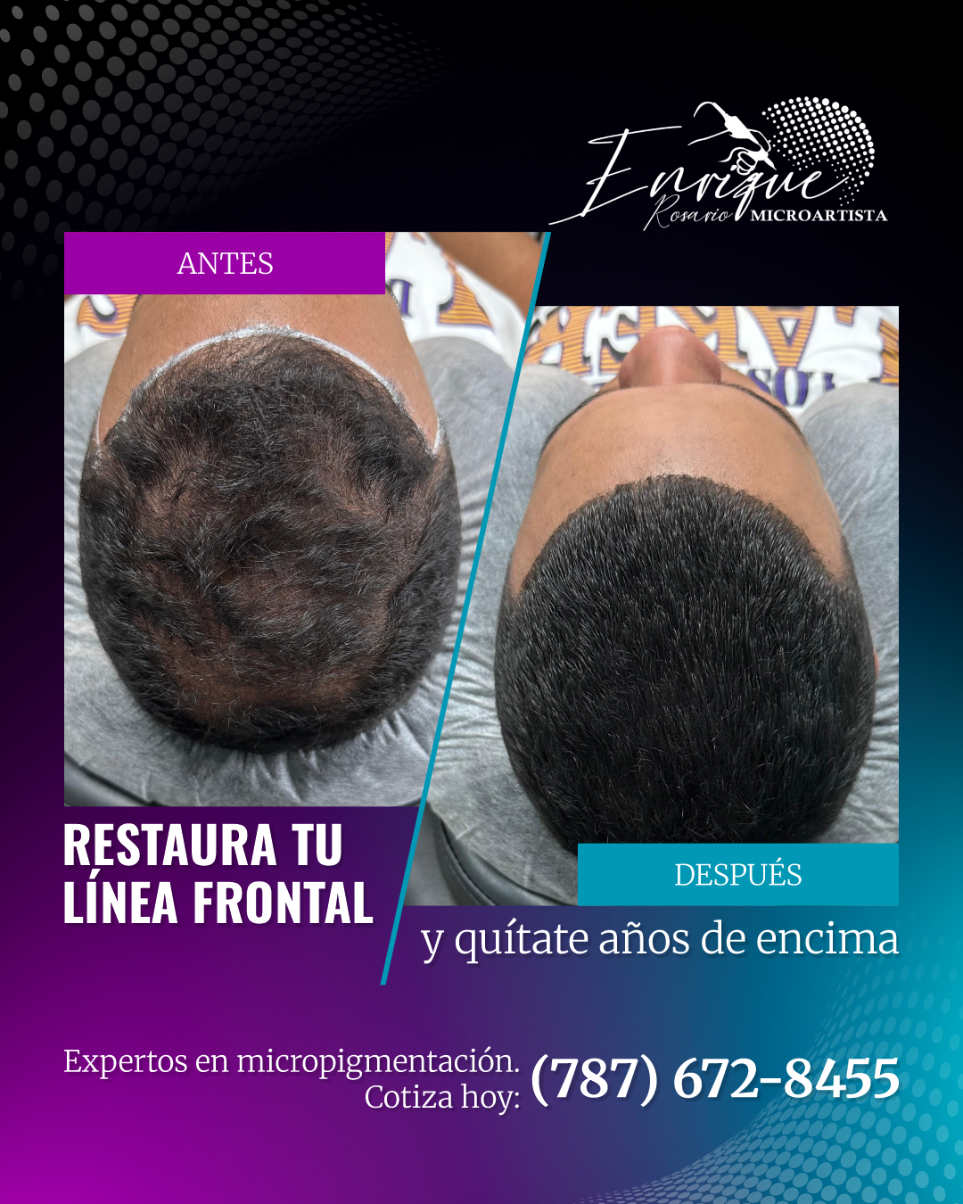 Enrique Micro Artista Facebook ad: Más Información