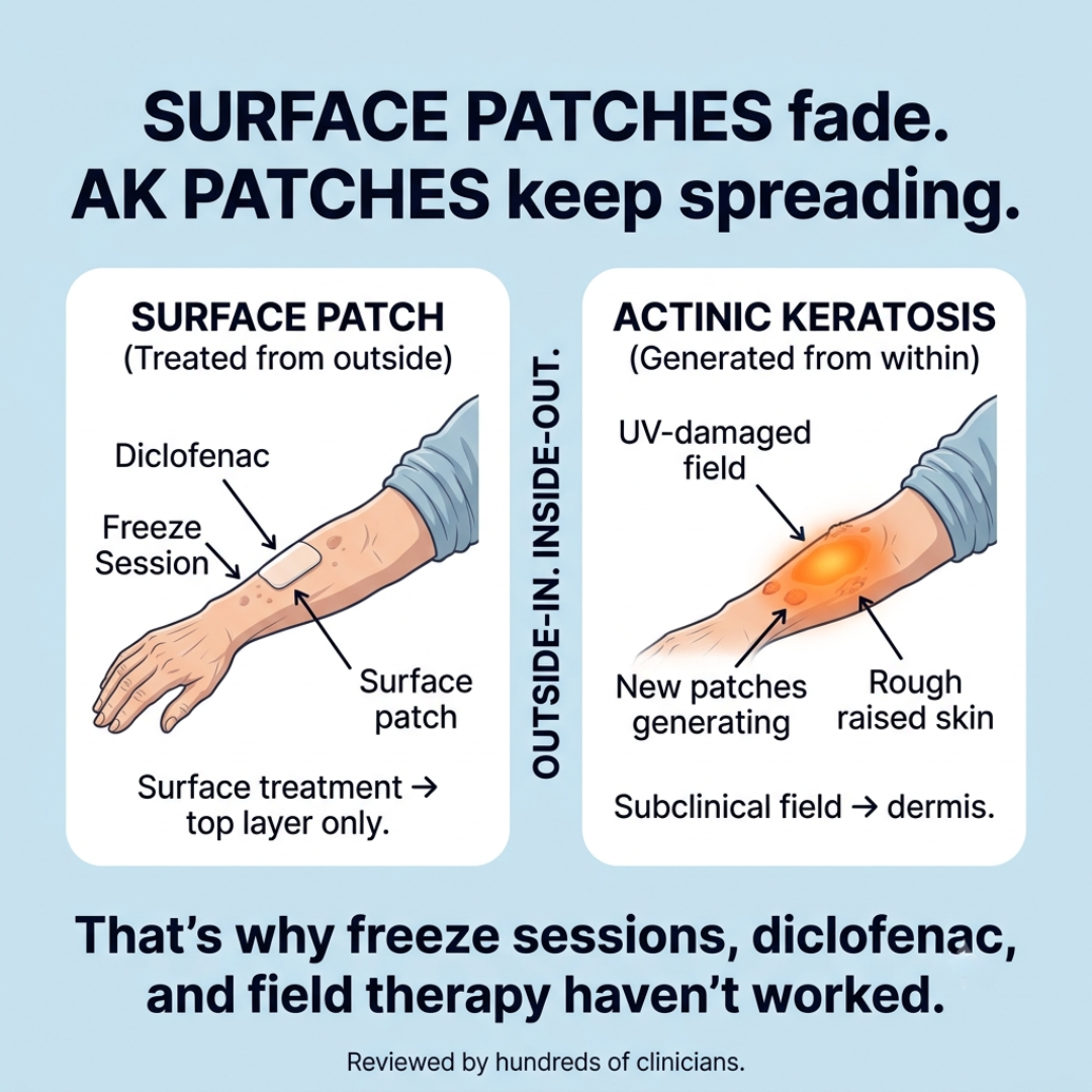 Actinic Keratosis Reset Facebook ad