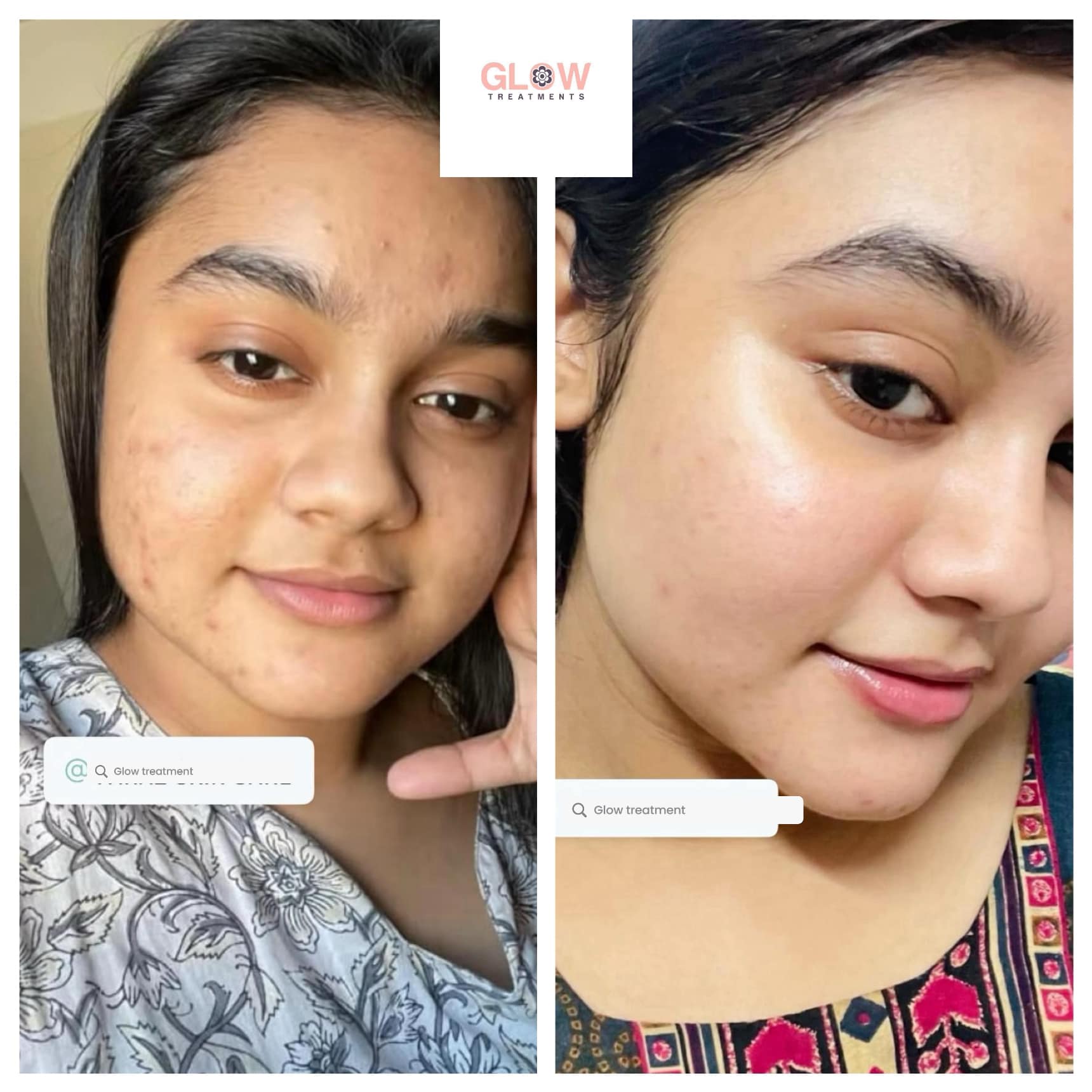 Glow Treatments Facebook ad: Glow Treatments Happy Customers