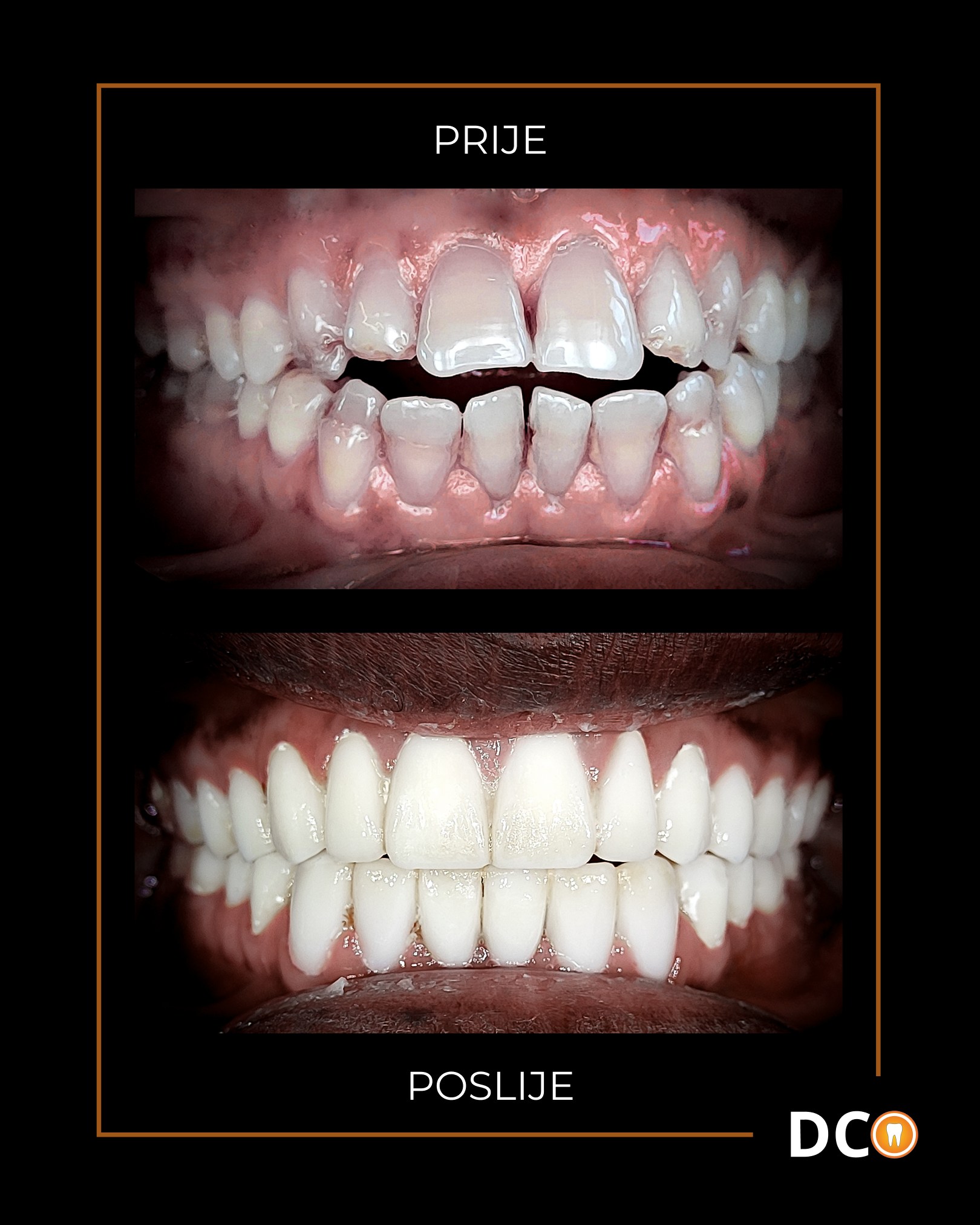 Dental Centar Ostojić Facebook ad