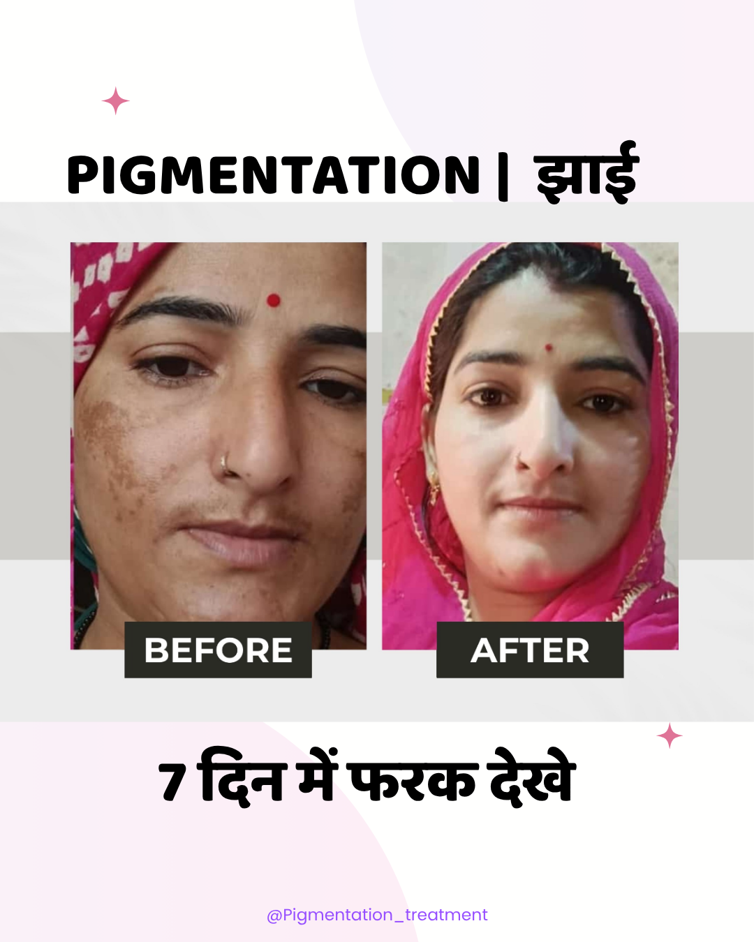 Nature Ayurveda Facebook ad